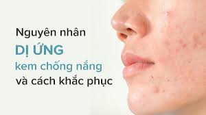 Triệu chứng dị ứng